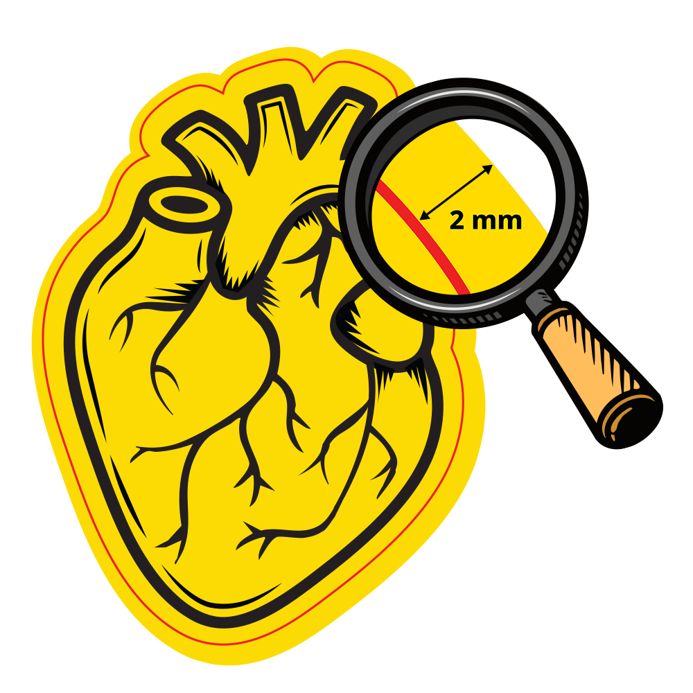 Illustration of a human heart with a magnifying glass highlighting a 2mm thick wall on the heart's surface, emphasizing detail.